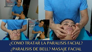 Masaje facial para parálisis de Bell [upl. by Bernadene279]