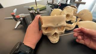 Skull Mandible and Maxilla bones and their bone markings [upl. by Airlee]