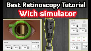 Retinoscopy Simulator  Practice Online  Tutorial [upl. by Ermeena]