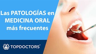 ODONTOLOGÍA las PATOLOGÍAS🤕en MEDICINA ORAL más frecuentes  Top Doctors 24 [upl. by Janean395]