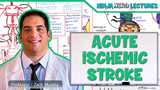 Acute Ischemic Stroke Etiology Pathophysiology Clinical Features Diagnostics Treatment [upl. by Alli28]