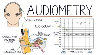 Understanding Audiometry and Audiograms [upl. by Htebazie123]