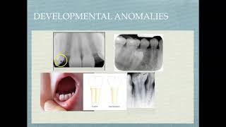 Radiographic Interpretation of Dental Materials Oral Pathology amp Dental Disease [upl. by Bronnie]