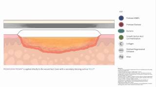 PROMOGRAN PRISMA™ Wound Balancing Matrix  Mode of action [upl. by Annahpos]