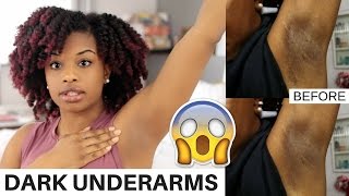 Amazing Results So Early  Musely Dark Spot Remover Reviews shorts [upl. by Ennayk]