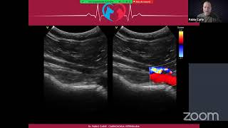 Webinar Ecocardiografia Doppler Veterinaria [upl. by Pugh]