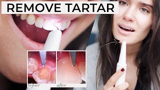 HOW TO REMOVE PLAQUE TARTAR AT HOME  Ultrasonic Tooth Cleaner Review  Does It Work [upl. by Aicire]