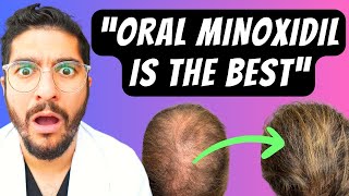 99 Miss This NEW Hair Loss Treatment – Dermatologist Explains [upl. by Naus]