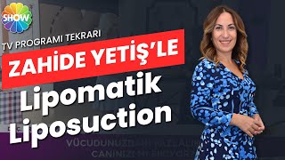 Lipomatik  Liposuction  Zahide Yetişle ShowTv [upl. by Ardek]