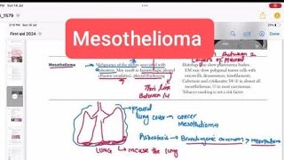 Mesothelioma pathology Respiratory 41  First Aid USMLE Step 1 in UrduHindi [upl. by Hughett]