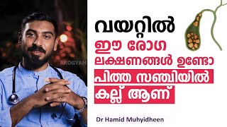 വയറ്റിൽ ഈ രോഗ ലക്ഷണങ്ങൾ ഉണ്ടോ പിത്ത സഞ്ചിയിൽ കല്ല് ആണ് സൂക്ഷിക്കുക  Understanding Gallstones [upl. by Melantha]