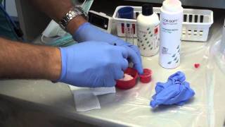 Denture Soft Reline Part 1 [upl. by Bradstreet]