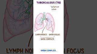 Clinical Cuts Mycobacterium tuberculosis [upl. by Sachsse493]