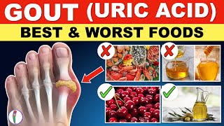 foods to avoid reduce uric acid naturally  home treatment doctor karthikeyan [upl. by Renee]