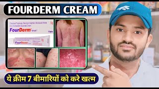 Fourderm cream uses in hindi and full review [upl. by Yra]