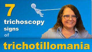 7 key trichoscopy features of trichotillomania [upl. by Feinstein810]