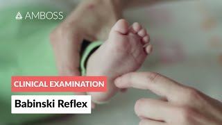 Babinski Reflex in Infants  Clinical Examination [upl. by Girhiny]