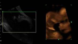 Life in the womb  4D sonogram of baby eating foot and [upl. by Lledrac]