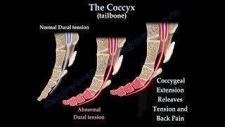 Coccydynia  coccyx pain coccyx pain causes diagnosis and treatment [upl. by Geralda700]