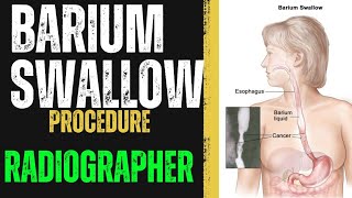 Barium Swallow Procedure  How to do Barium Swallow  Radiographer  X RAY Radiographer  Radiology [upl. by Anelrac]