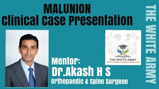 MALUNION Clinical Case Presentation [upl. by Trotter393]