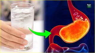 How To Treat Acid Reflux Naturally in 1 Min  Heartburn Relief Instantly [upl. by Aniroc930]