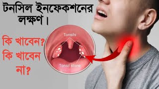 টনসিল ইনফেকশনের লক্ষণ  Tonsils infection symptoms  tonsil treatment at home in bengali [upl. by Arhaz]