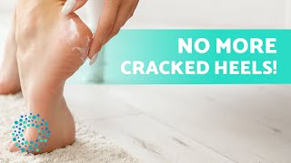 How to REMOVE FOOT DRYNESS 🦶🏽 Cause Treatments and Home Remedies [upl. by Idzik]