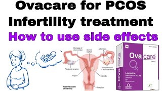 how to use Ovacare  Multivitamin tablet For PCOS  infertility  How to use  Dose  side effects [upl. by Gereron]