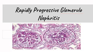 Rapidly Progressive Glomerulonephritis  RPGN [upl. by Keldah234]