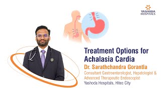 Treatment Options for Achalasia Cardia  Yashoda Hospitals Hyderabad [upl. by Tab]