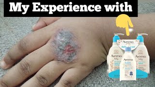 Aveeno Baby Product Review Are Aveeno Baby Products Good  Aveeno Eczema Therapy [upl. by Rifkin]