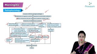 Meningitis Hindi  Internal Medicine [upl. by Cirek415]