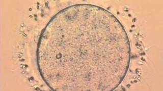 IVF Sperm trying to penetrate an egg [upl. by Initof]