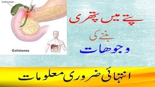 Gallstone Symptoms And Causes in UrduHindipitte ki pathri ki wajohat [upl. by Thom]