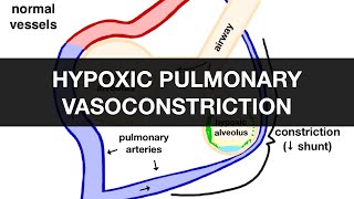 Hypoxic Pulmonary Vasoconstriction HPV [upl. by Atiuqehs]