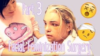 Facial Feminization Surgery  Day 5 amp 6 GRAPHIC  Stef Sanjati [upl. by Enialahs]