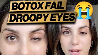 Botox Gone Wrong Droopy Eye  Cheap Fix [upl. by Der634]