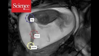 Snippet Tracking fetal movements at 24 weeks [upl. by Clarkin975]