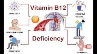 Top 6 Vitamin B12 DEFICIENCY Symptoms YOU NEED TO KNOW [upl. by Enylhsa]