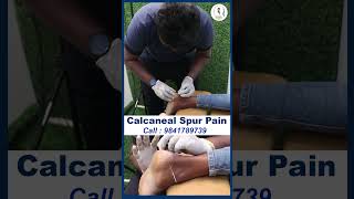 Calcaneal Spur Pain treatment  DrVijay Non Surgical  Chiropractic Treatment [upl. by Avitzur969]