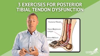 3 Exercises for Posterior Tibial Tendon Dysfunction [upl. by Nylirej]