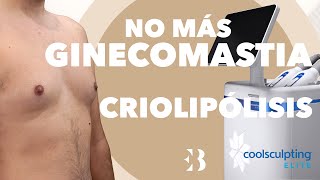 Criolipólisis  No más Ginecomastia con el tratamiento de Criolipólisis [upl. by Lissy303]