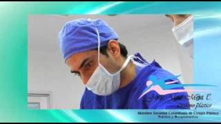 Abdominoplastia  Video [upl. by Nappie]