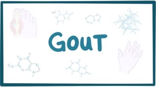 Gout  causes symptoms diagnosis treatment pathology [upl. by Hcaz]