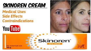 Skinoren Cream  Medical Uses  Face Whitening Agent [upl. by Nysila]