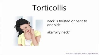 Torticollis [upl. by Primavera844]