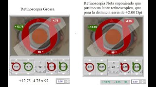 Todo lo que debes saber antes de usar el simulador de Retinoscopía Estática de Alcon [upl. by Enogitna]