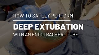 Deep Endotracheal Extubation [upl. by Clower]