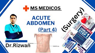 Michaels diverticulumAcute abdomenSurgeryMS Medicos Dr RizwanUrdu Hindi Easy Explanations [upl. by Tibbs730]